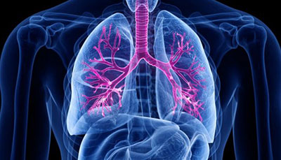 什么是慢性阻塞性肺病 (Chronic Obstructive Pulmonary Disease)，為何與新冠疫情有關？